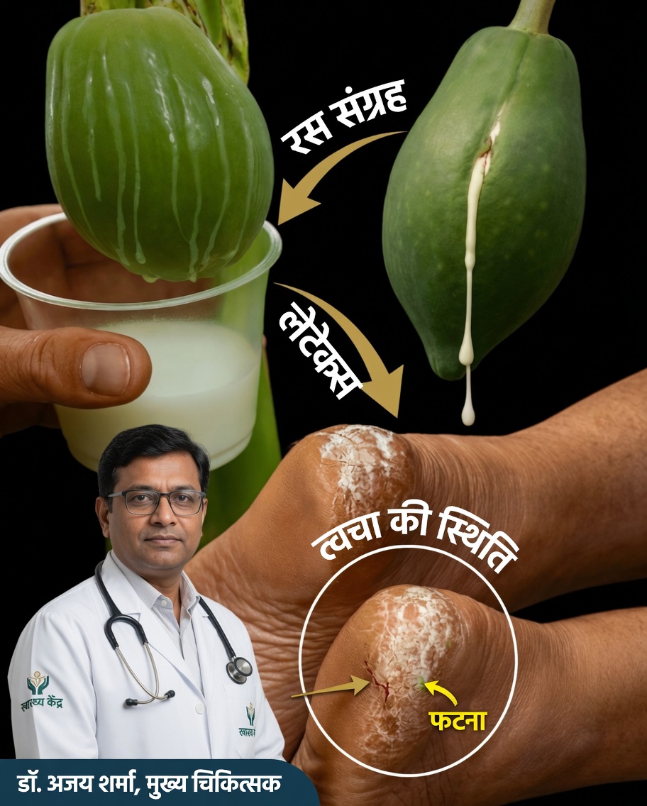 18 लाभकारी और चौंकाने वाले पपीते के लेटेक्स (पपीते का दूध) के फायदे और इसे कैसे उपयोग करें