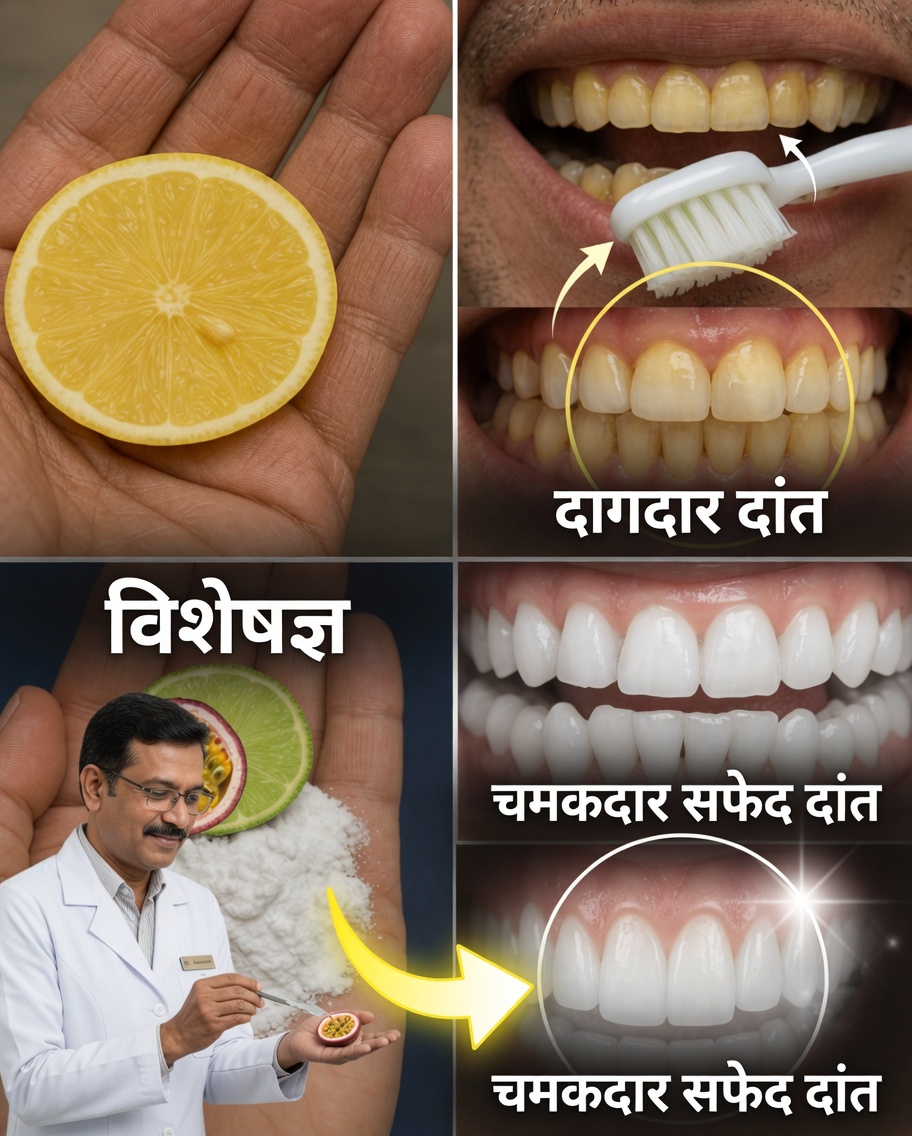 नींबू और बेकिंग सोडा से पाएं और भी सफेद मुस्कान