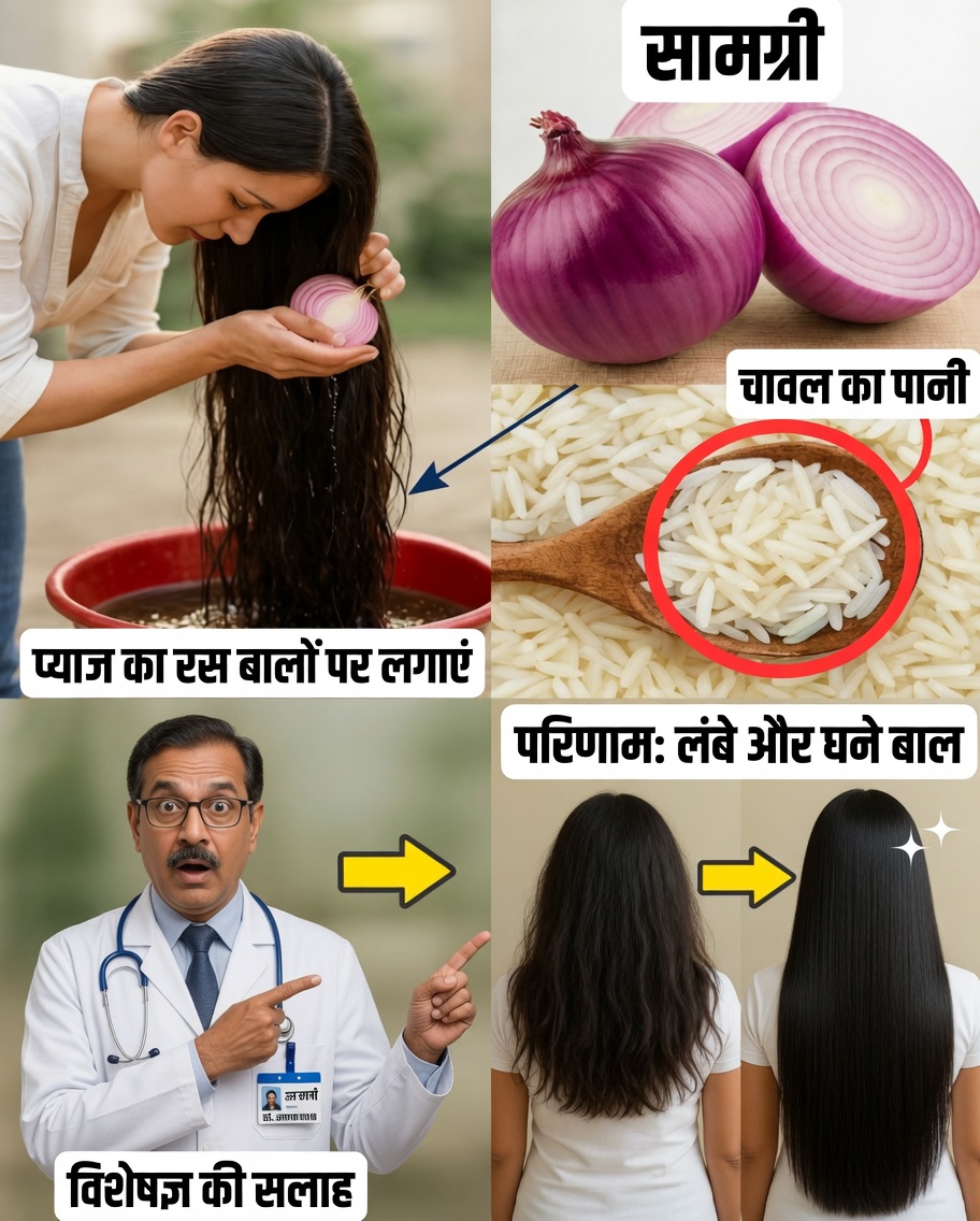 यह नुस्खा आपके बालों को पागलों की तरह बढ़ा देगा: बालों को लंबा और घना करने के लिए प्याज़ और चावल की ताकत
