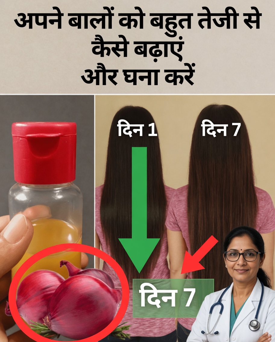 बालों की तेज़ वृद्धि और झड़ना रोकने के लिए प्याज का तेल कैसे बनाएं