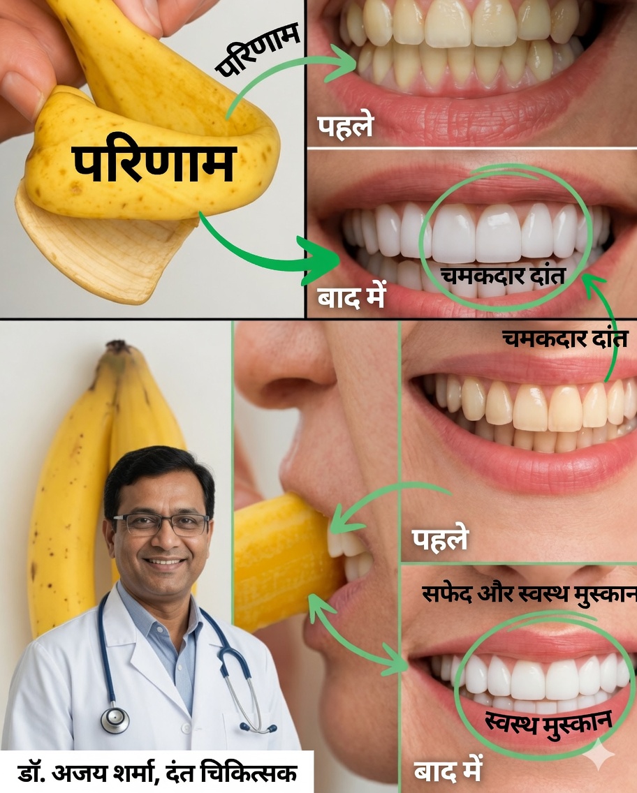 केवल 2 मिनट में केले के छिलके से अपनी मुस्कान को चमकाएँ