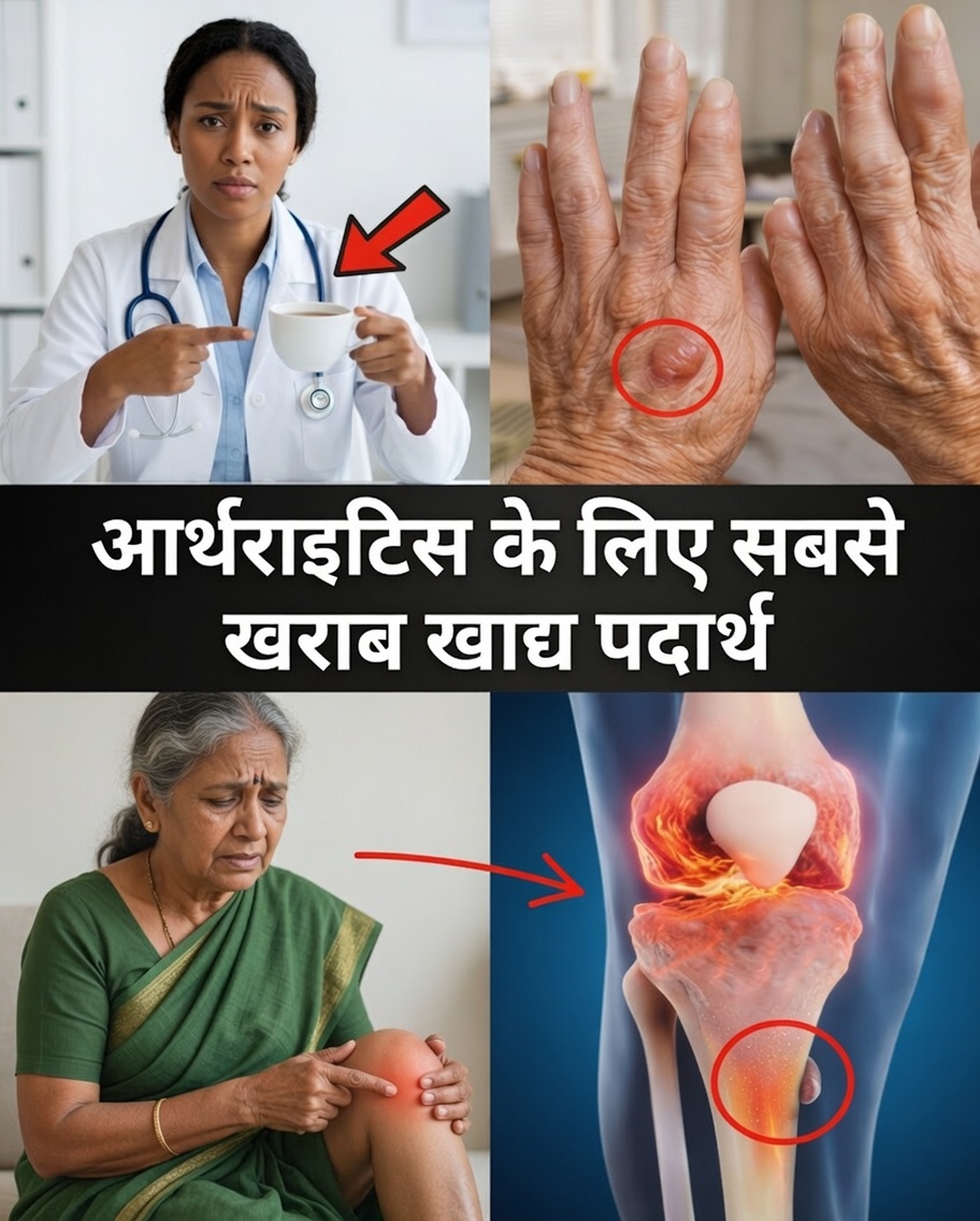 सबसे बुरे खाद्य पदार्थ जो चुपचाप आपके गठिया के दर्द को बढ़ा रहे हो सकते हैं — और क्षारीय खाद्य पदार्थ जो राहत में मदद कर सकते हैं