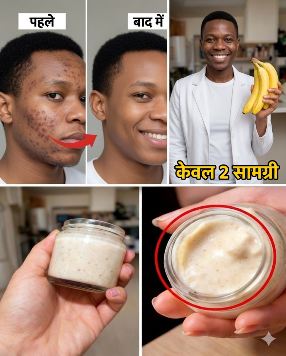 केले के छिलके का उपयोग करके महीन रेखाओं को कम करने और त्वचा को निखारने के 7 प्राकृतिक तरीके