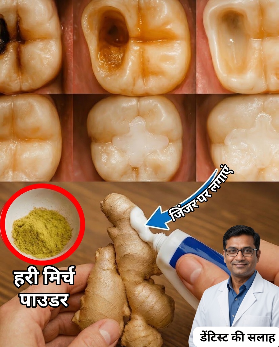 क्या आप कैविटीज़ से थक गए हैं? जानिए अपने दाँतों को प्राकृतिक रूप से कैसे मज़बूत करें