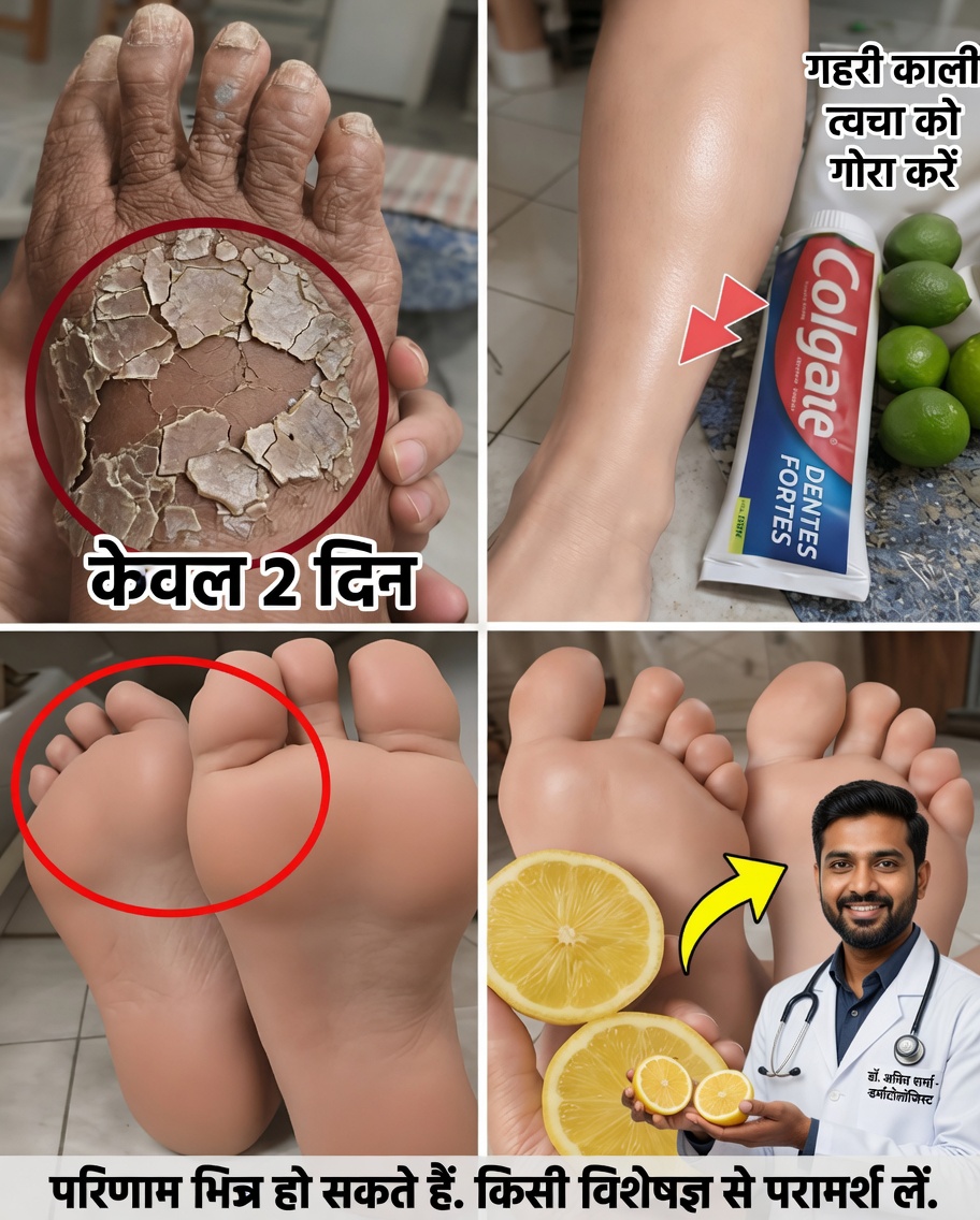 सरल दैनिक आदतें जिन्होंने मेरी टांगों की दिखावट में सुधार किया, जिससे त्वचा अधिक चिकनी, चमकदार और स्वस्थ हो गई