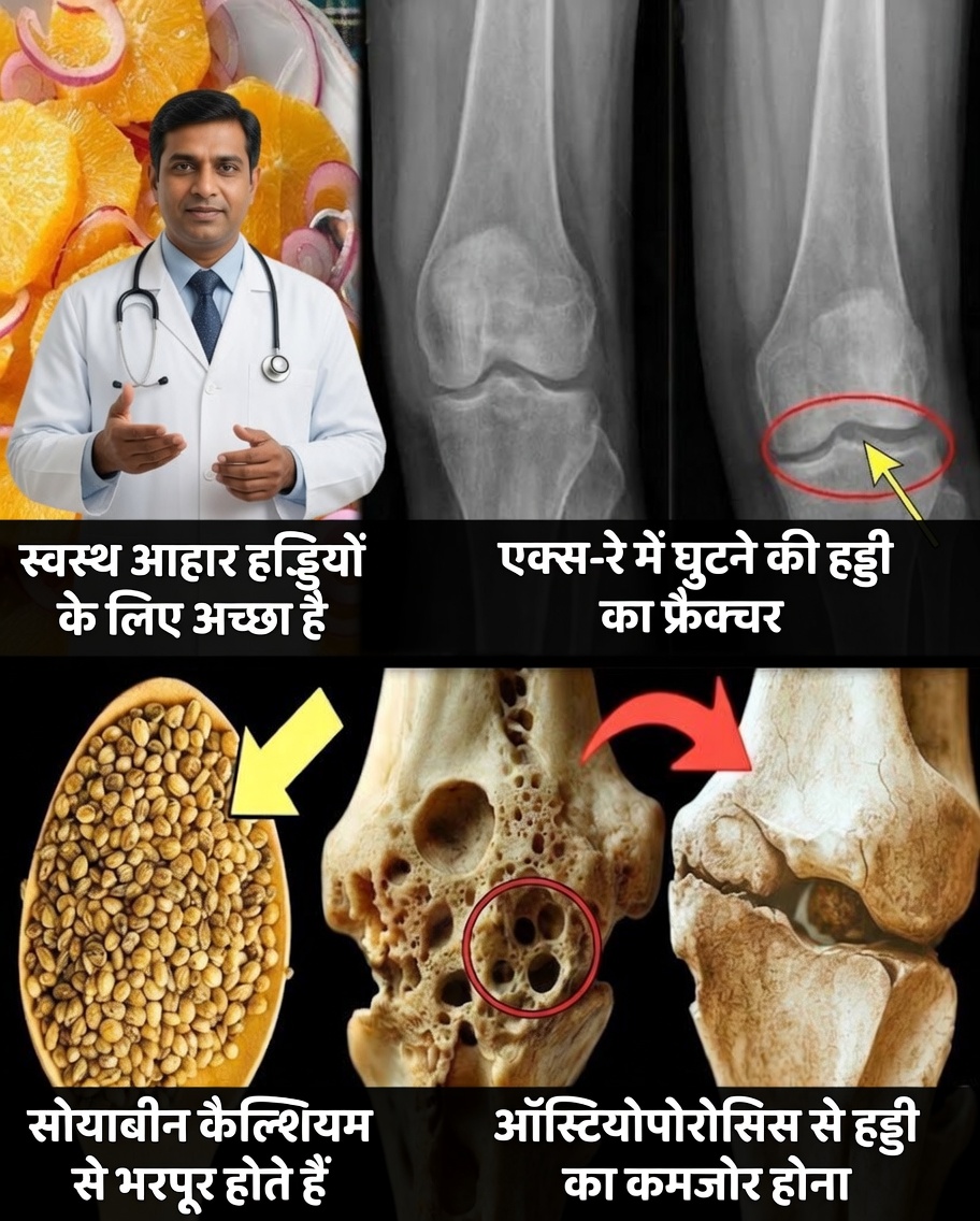 ऑस्टियोपोरोसिस चेतावनी: एक प्राकृतिक खाद्य पदार्थ जो कमजोर हड्डियों को मजबूत बनाने में मदद कर सकता है