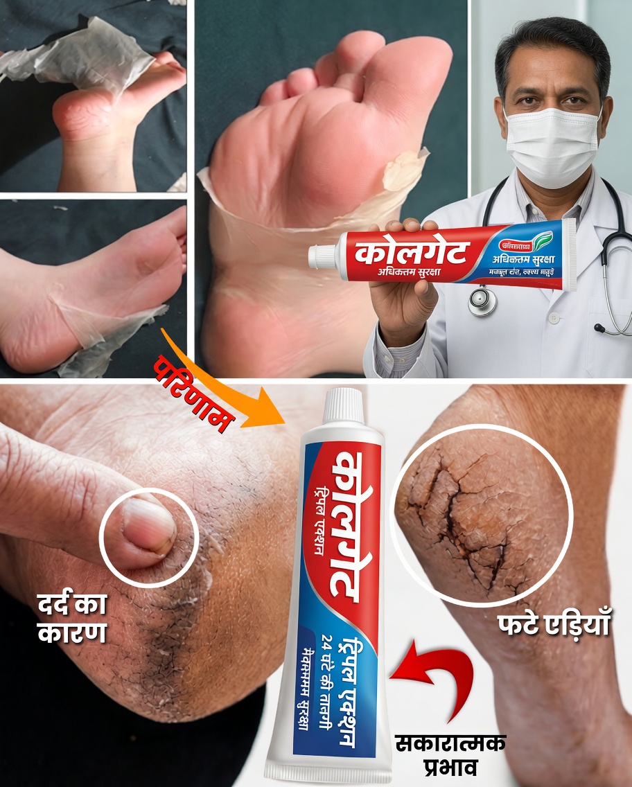 कोलगेट से पैरों की देखभाल का रहस्य: मुलायम और स्वस्थ पैरों के लिए एक आसान तरीका