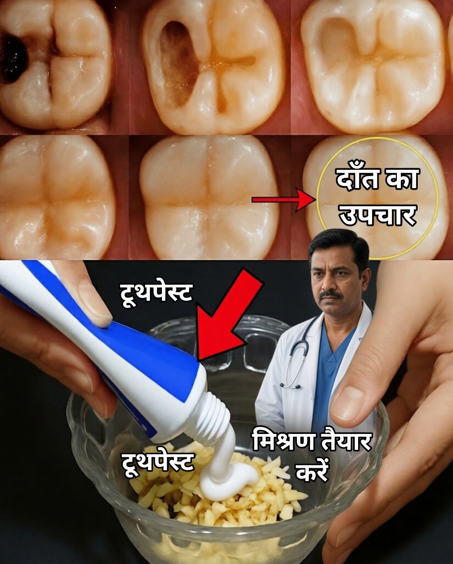 दंत चिकित्सक शायद ही कभी बताते हैं: प्राकृतिक सुझाव जो कैविटी रोकने में मदद कर सकते हैं