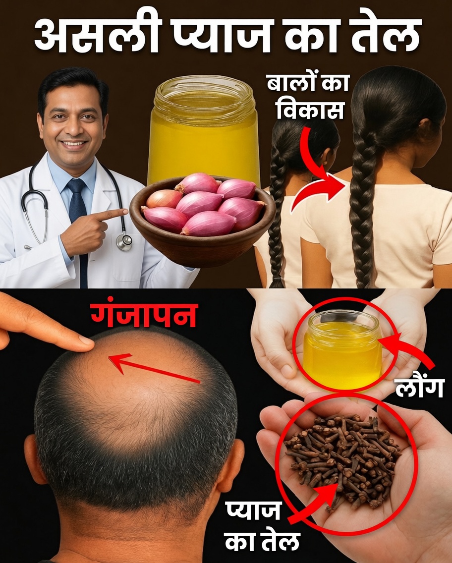 प्याज़ के तेल का चमत्कार: कैसे मेरी खोपड़ी के गंजे पैच सिर्फ़ 16 दिनों में गायब होने लगे