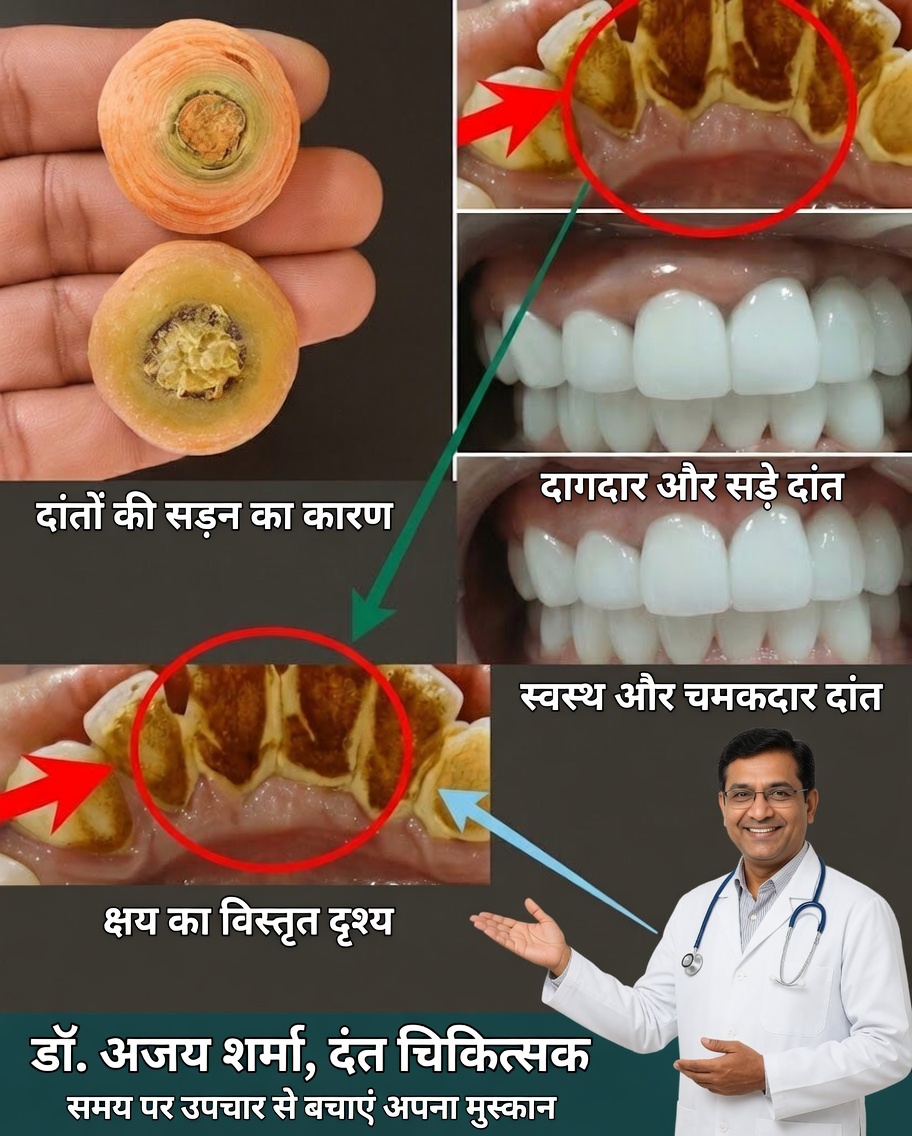 अपनी मुस्कान को प्राकृतिक रूप से मजबूत करें: दांतों और मसूड़ों की सुरक्षा के लिए शक्तिशाली रहस्य