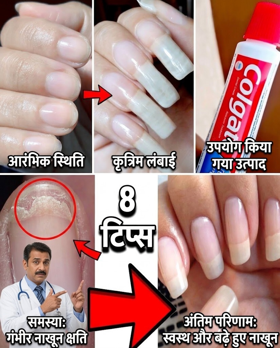 कमजोर नाखूनों को प्राकृतिक रूप से पुनर्जीवित करें: मजबूत, स्वस्थ नाखूनों के लिए लहसुन का शक्तिशाली रहस्य