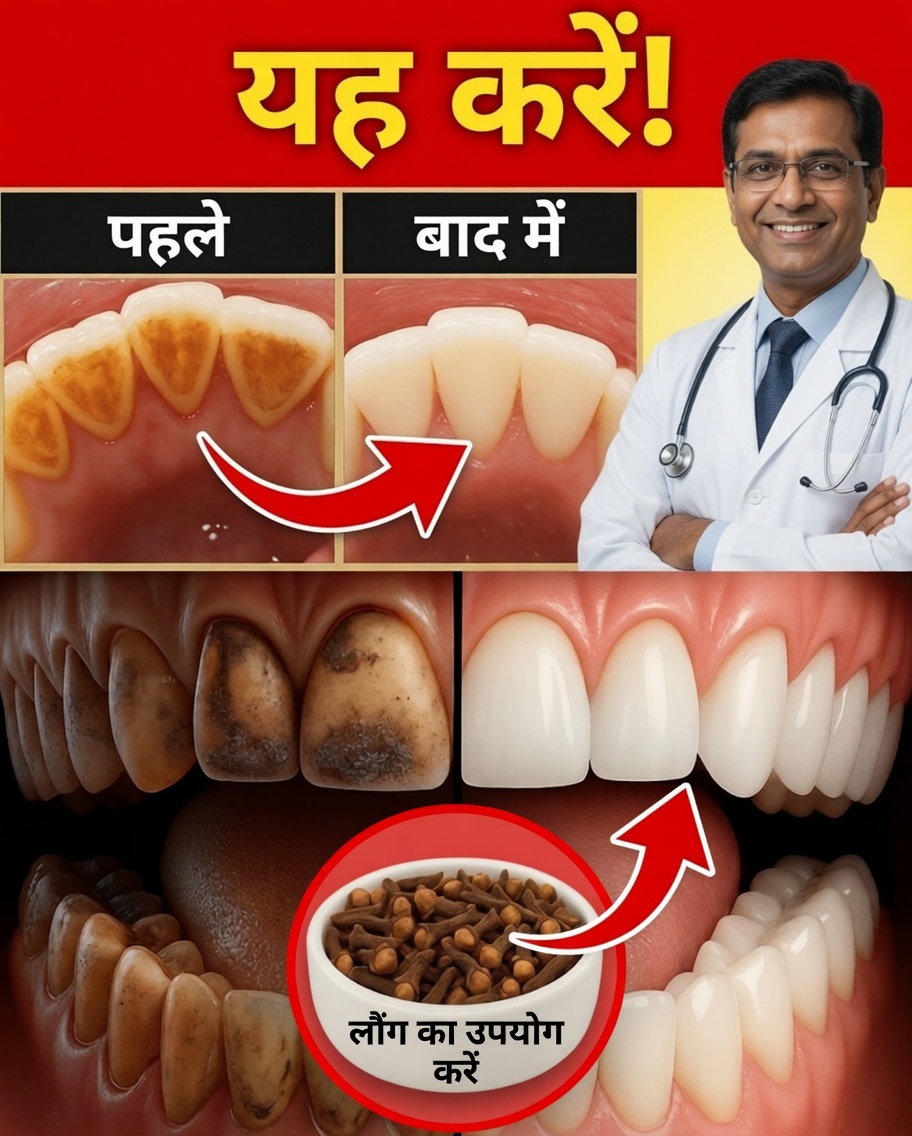 प्लाक और टार्टर को प्राकृतिक रूप से हटाने के लिए 9 सिद्ध घरेलू उपचार
