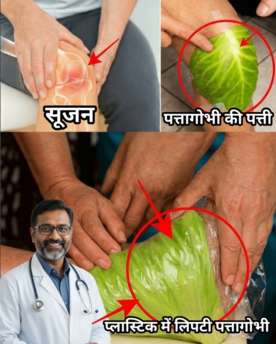 आपकी टांगों के चारों ओर पत्तागोभी के पत्ते लपेटना: आश्चर्यजनक लाभों वाला एक सरल प्राकृतिक उपचार