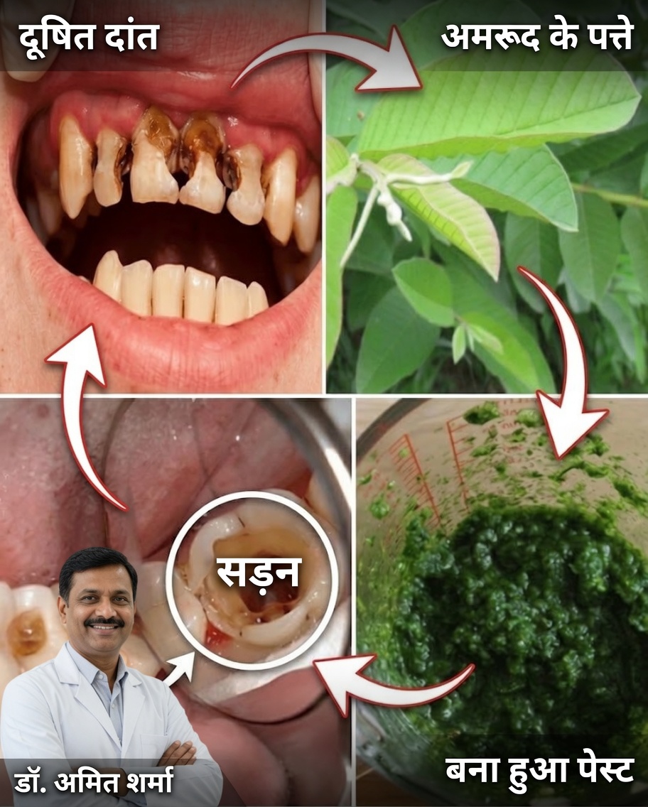 चमकदार मुस्कान के लिए अमरूद के पत्ते: 70 वर्षीय दादी द्वारा पीढ़ियों से चला आ रहा प्राकृतिक मौखिक देखभाल का रहस्य