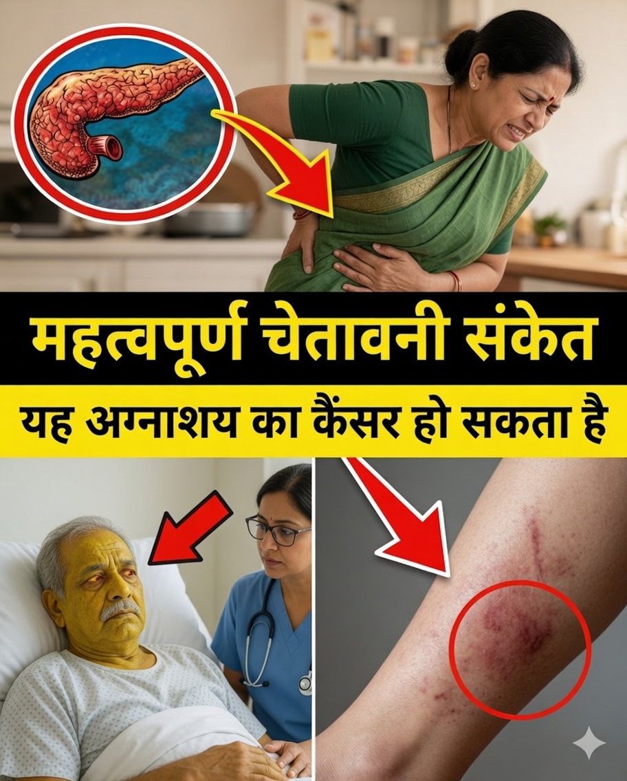 कैंसर अग्न्याशय के 10 छिपे हुए चेतावनी संकेत जिन्हें आप शायद नज़रअंदाज़ कर रहे हैं