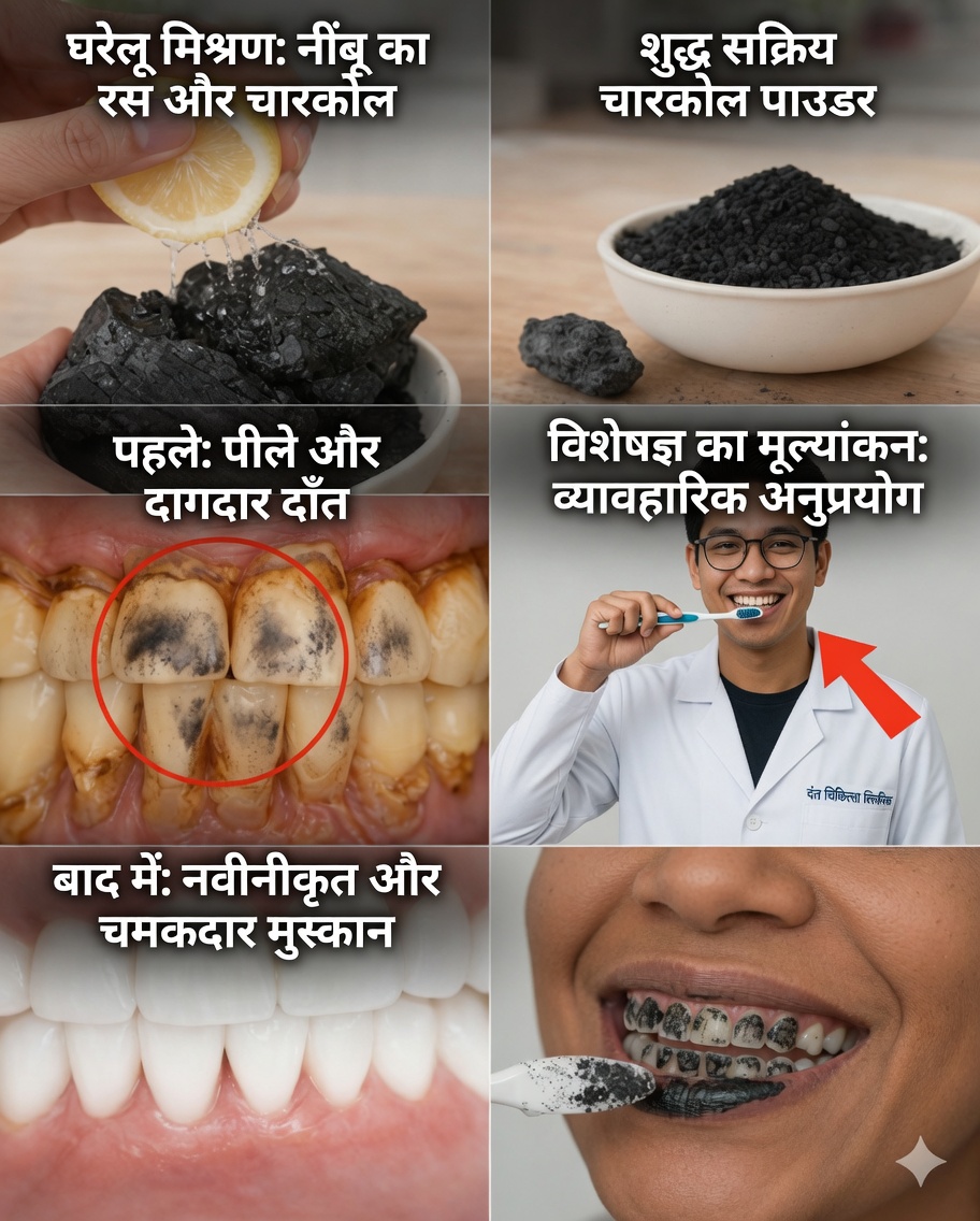 सुरक्षित तरीके से दाँत कैसे सफेद करें: चारकोल और नींबू के बारे में सच्चाई (और वास्तव में क्या काम करता है)