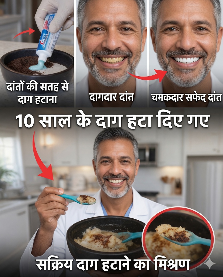 केवल 2 मिनट में दाँतों के 10 साल तक के दाग हटाएँ – वह प्राकृतिक व्हाइटनर जो सबका ध्यान खींच रहा है