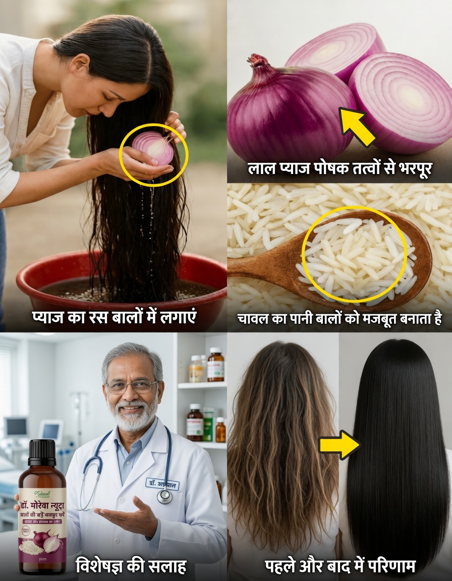 प्याज और चावल का हेयर मास्क जो पतले बालों को लंबे, घने और चमकदार बालों में बदल सकता है